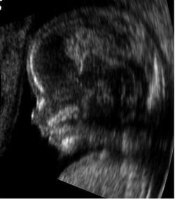Embryo at 14 weeks profile.JPG
