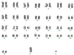 Karyotype of normal male goat.png