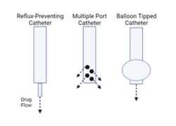 Novel Catheter Designs for Use with CED.png