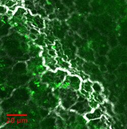 SHG collagen in liver.jpg