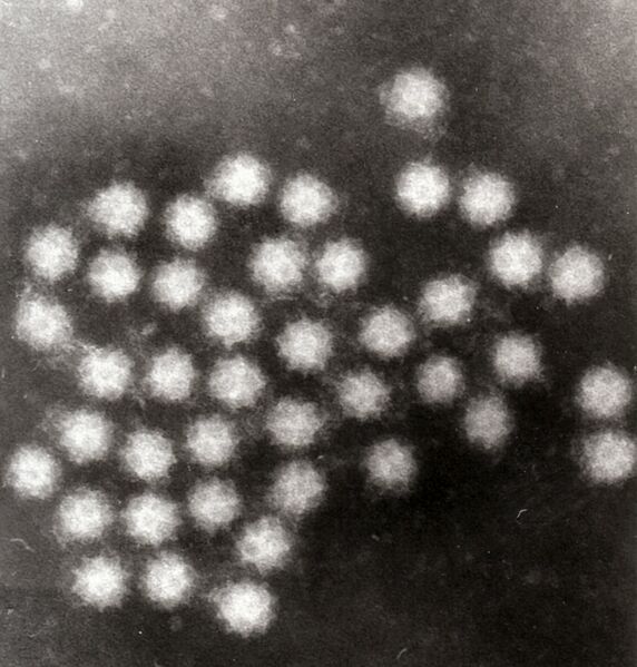 File:Sappovirus.jpg