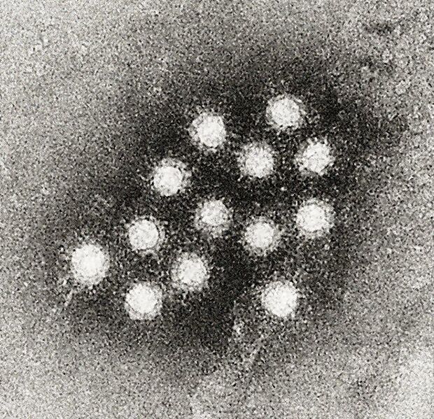 File:Hepatitis A virus 02.jpg