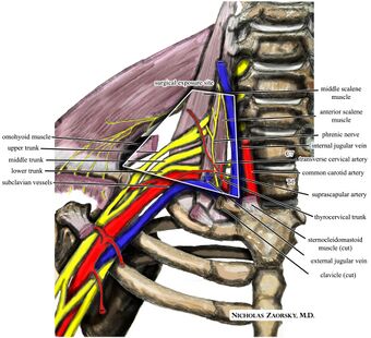 Wikipedia medical illustration thoracic outlet syndrome brachial plexus anatomy with labels.jpg