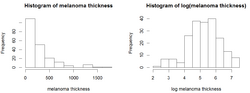 Histograms of melanoma thickness.png