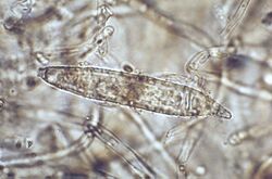 Microsporum audouinii macroconidium.jpg