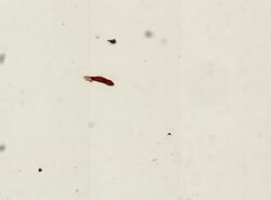 Gyrodactylus elegans (YPM IZ 094251).jpeg
