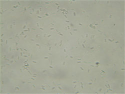 Phoma spores 160X.png