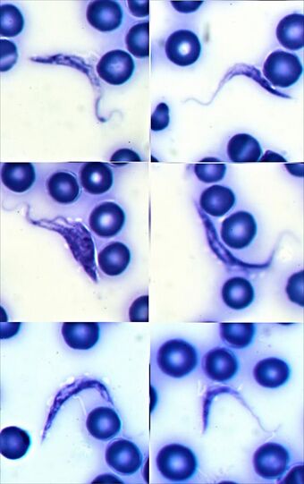 Crescent-shaped Trypanosoma cruzi parasites surrounded by red blood cells