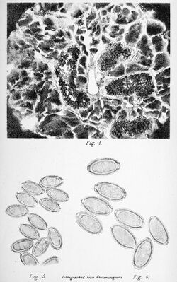 Trichocephalus hepaticus Bancroft 1893 - Plate VIII.jpg
