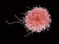 A natural killer cell, the most common type of null cell