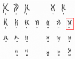 Human male karyotpe high resolution - Chromosome 12.png