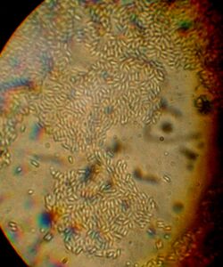 Laternea spores 1000x.JPG