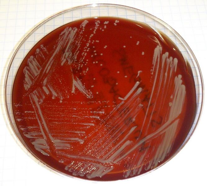 File:Mycobacterium smegmatis.jpg