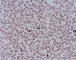 Nucleated red cells.jpg