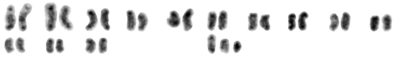 File:Karyotype of male bed bug (Cimex lectularius).png