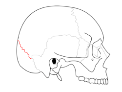 Lambdoid suture.png