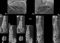 Photographs of jaws and teeth