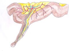 Diverticule de Meckel.jpg