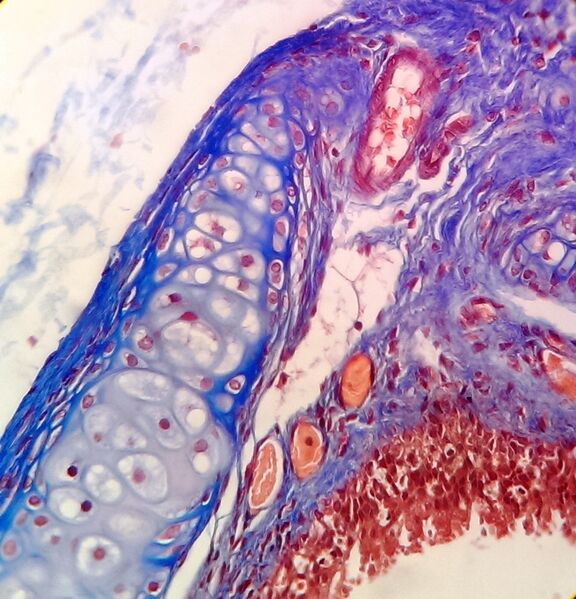File:Masson's trichrome staining on rat's trachea.jpg