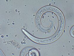 "Angiostrongylus vasorum" (male) from canine blood sample.