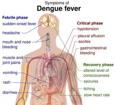 Outline of a human torso with arrows indicating the organs affected in the various stages of dengue fever