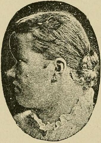 Profile view of patient